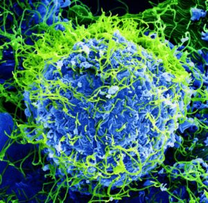 Ebola: Is the U.S. Ready?