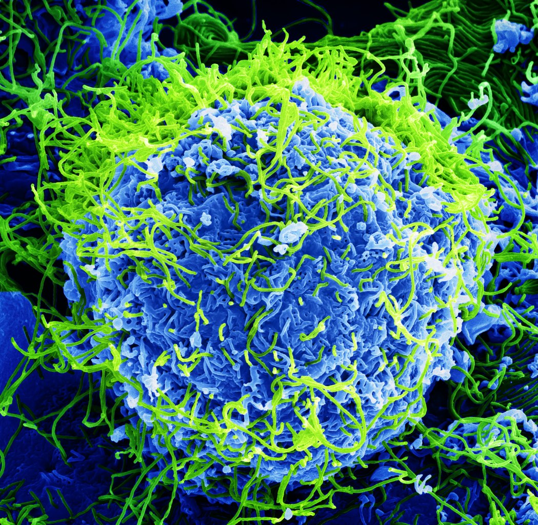 Ebola virus particles around a cell